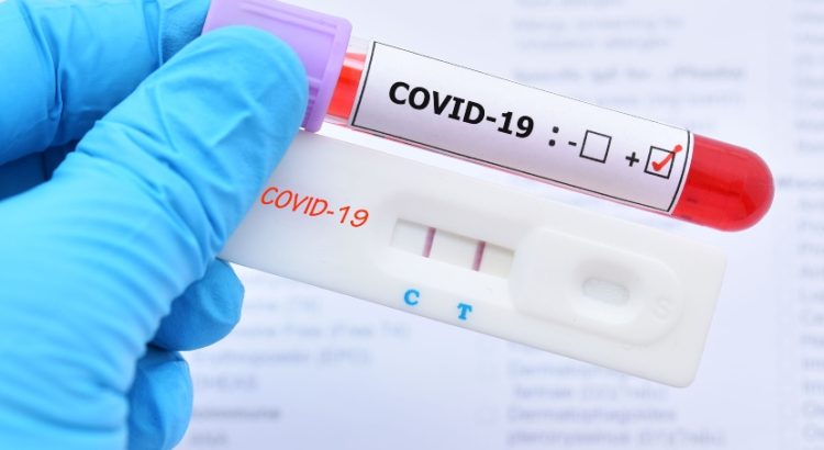 This Simple Device Could Be the Future of Home Diagnostics