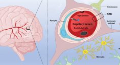 This Hidden Symptom Could Be a Sign of Long COVID Mental Strain