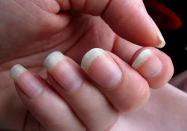 What Your Fingernails Could Reveal About Your Health
